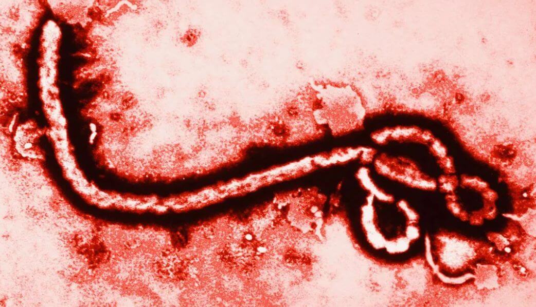 как выглядит лихорадка эбола фото