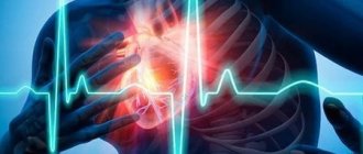 Причины и факторы, которые влияют на развитие инфаркта